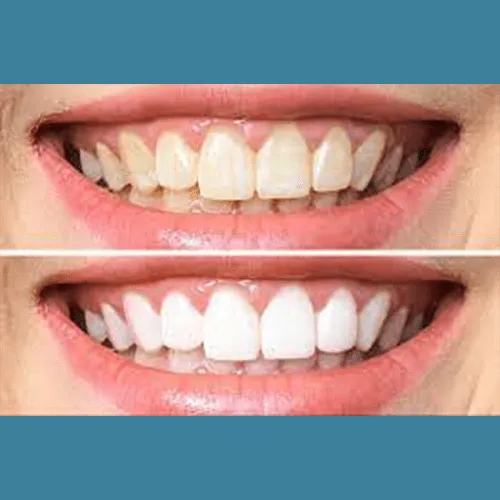 State-of-the-art technology