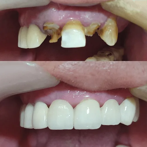 Sterilisation & safety area